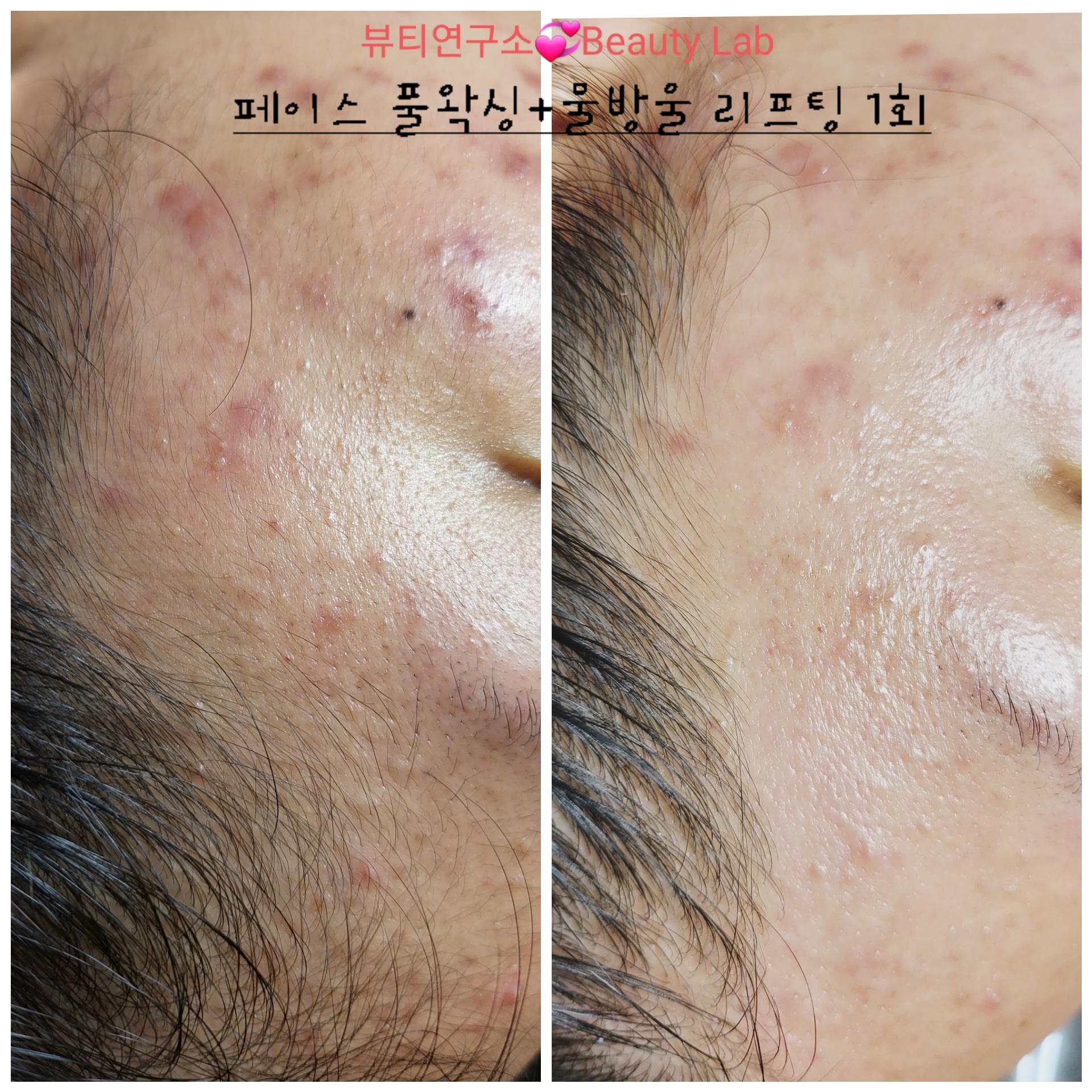 박선영 피부관리 뷰티연구소 백석점