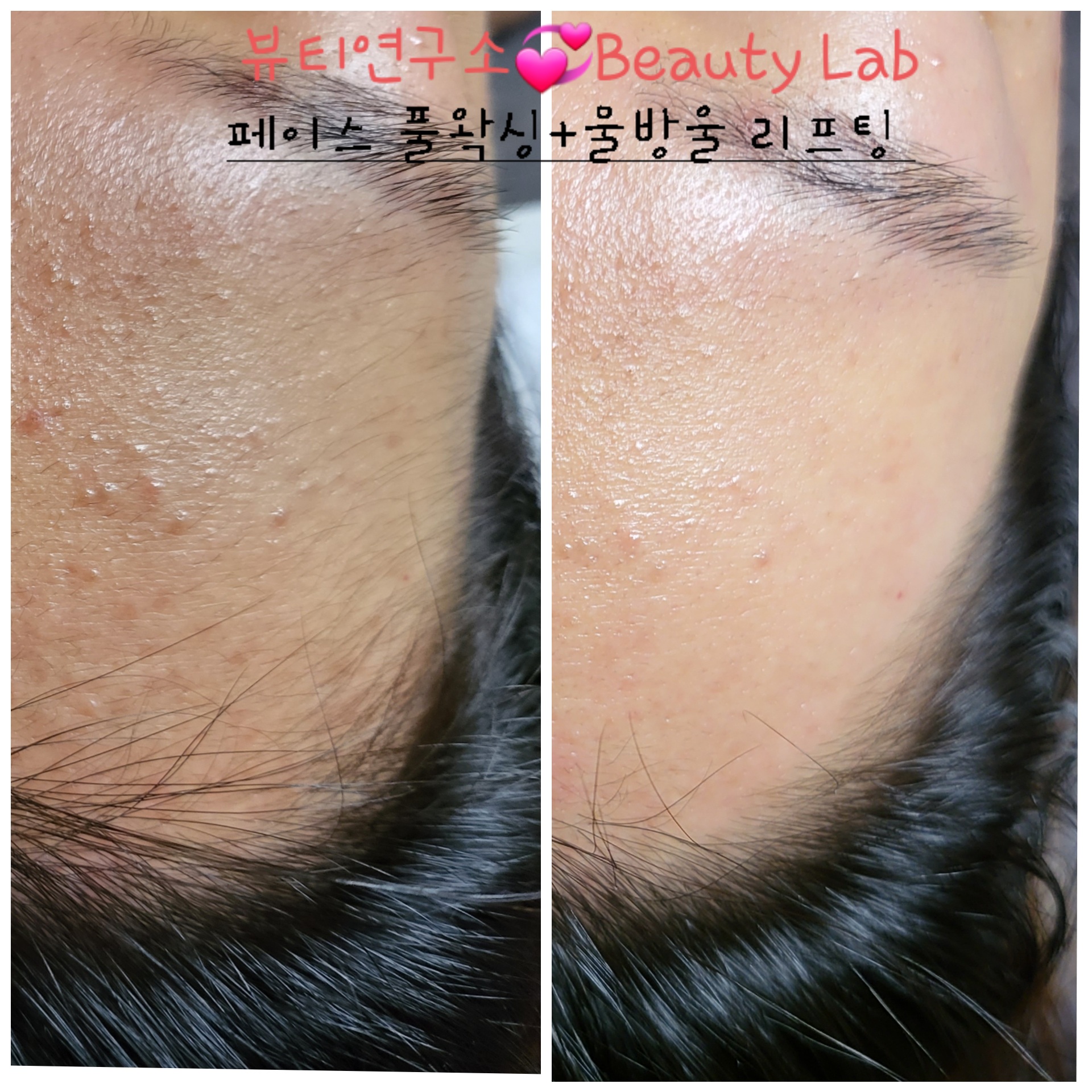 박선영 피부관리 뷰티연구소 백석점