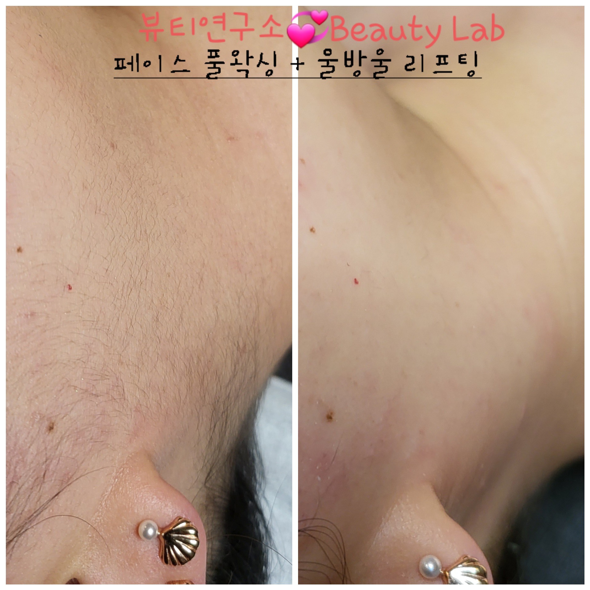 박선영 피부관리 뷰티연구소 백석점