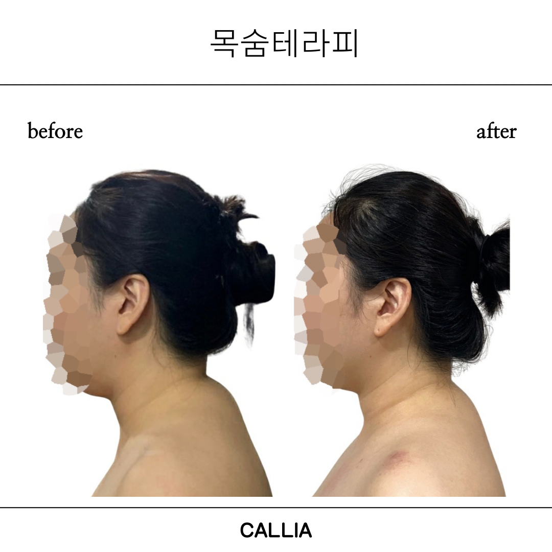 매끄롬 대구죽전점