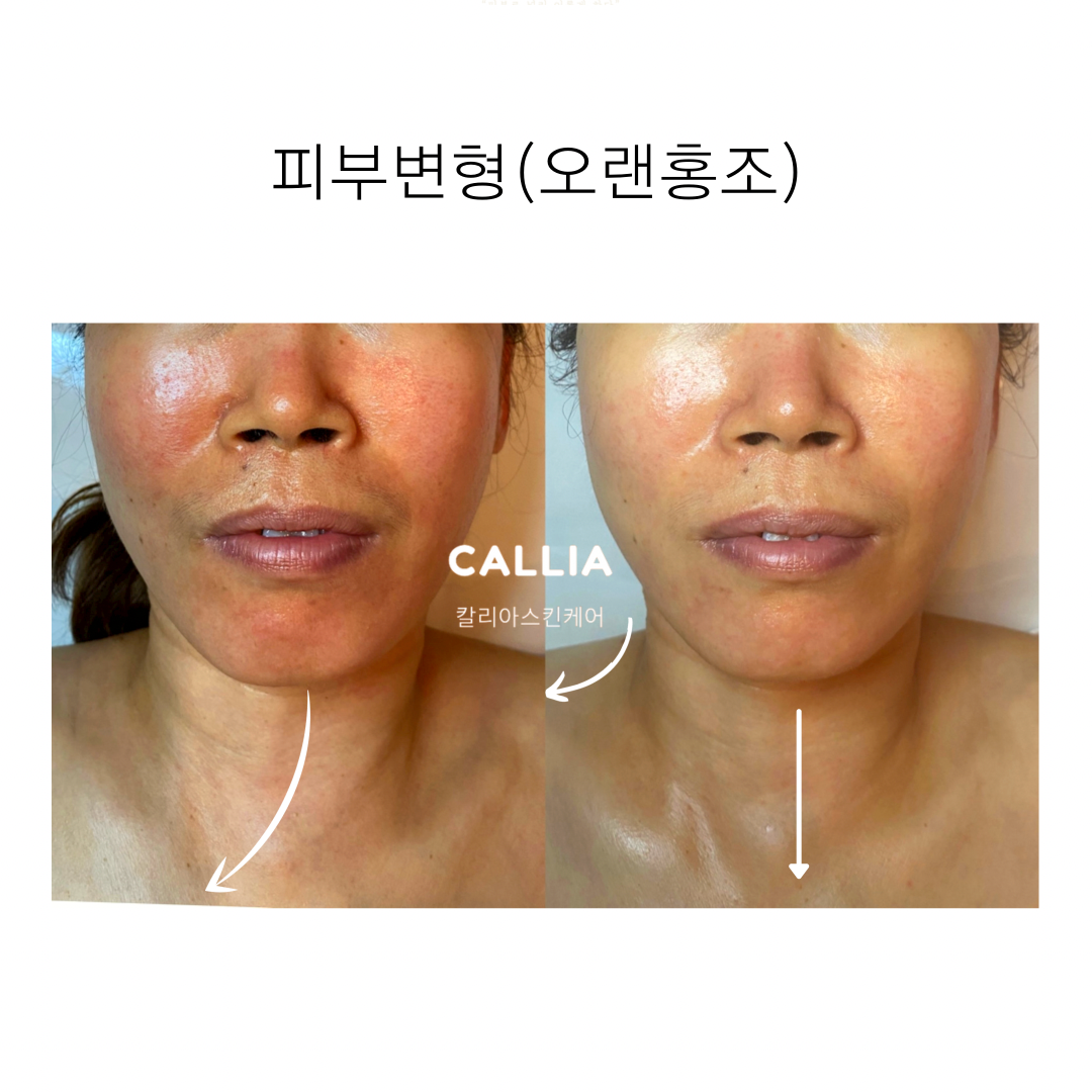 매끄롬 대구죽전점