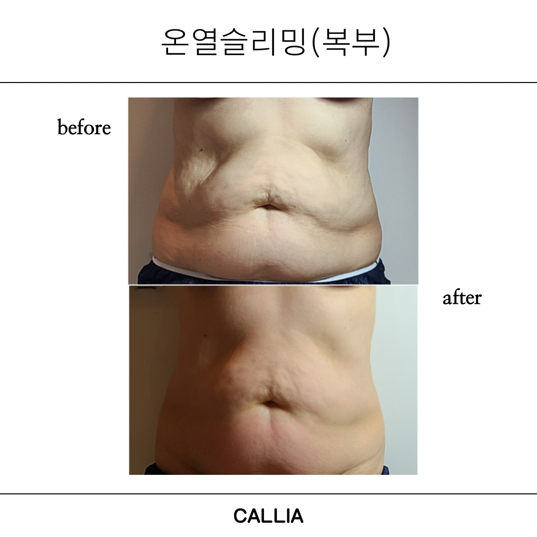 매끄롬 대구죽전점