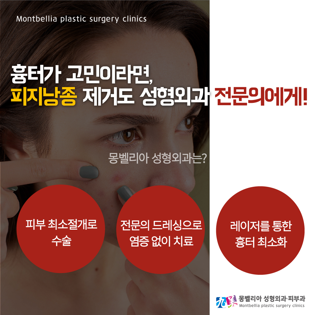 몽벨리아성형외과의원 대표 이미지