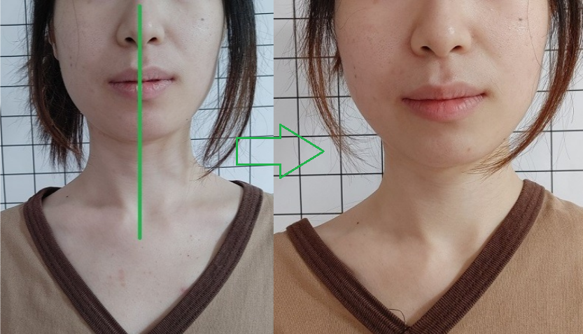 인천체형교정 photo 7