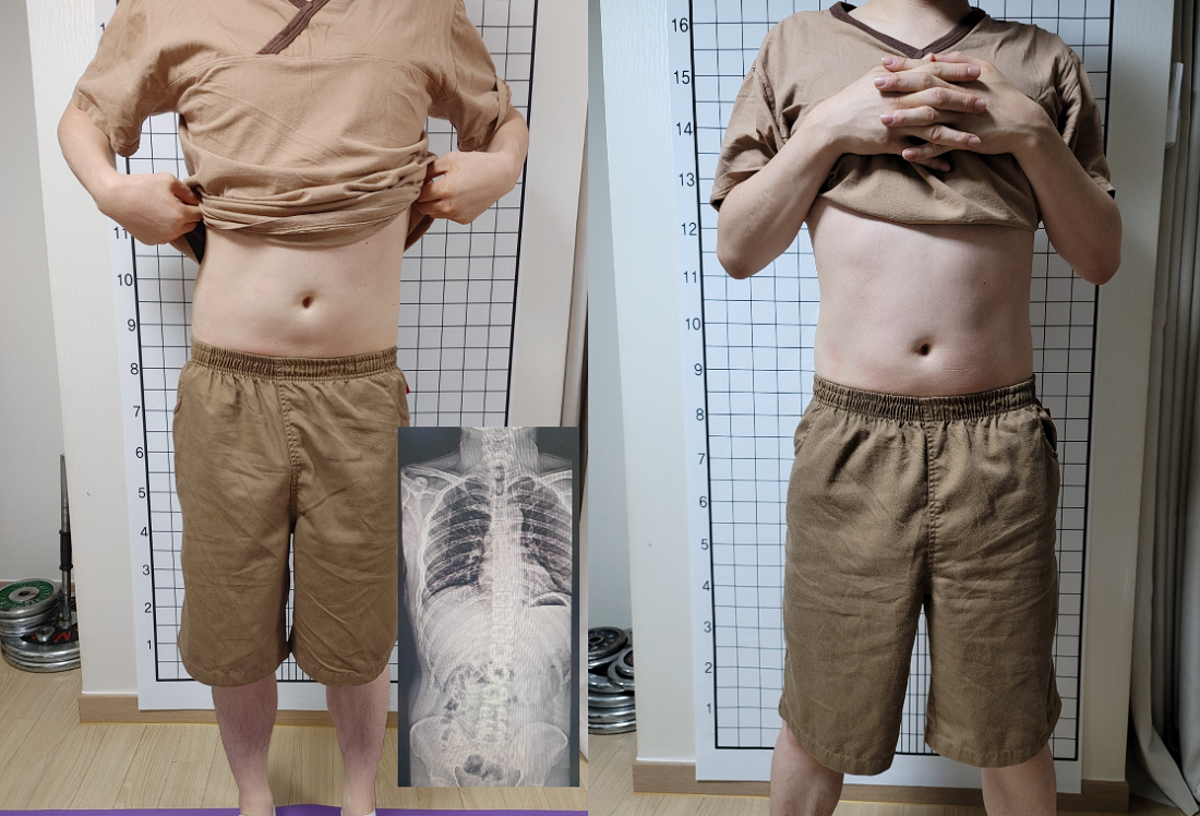 인천체형교정 photo 5