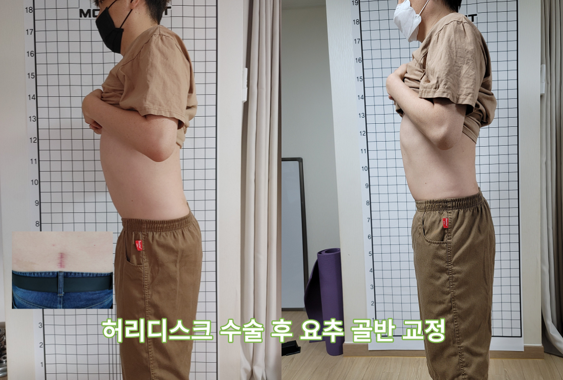 인천체형교정 photo 4