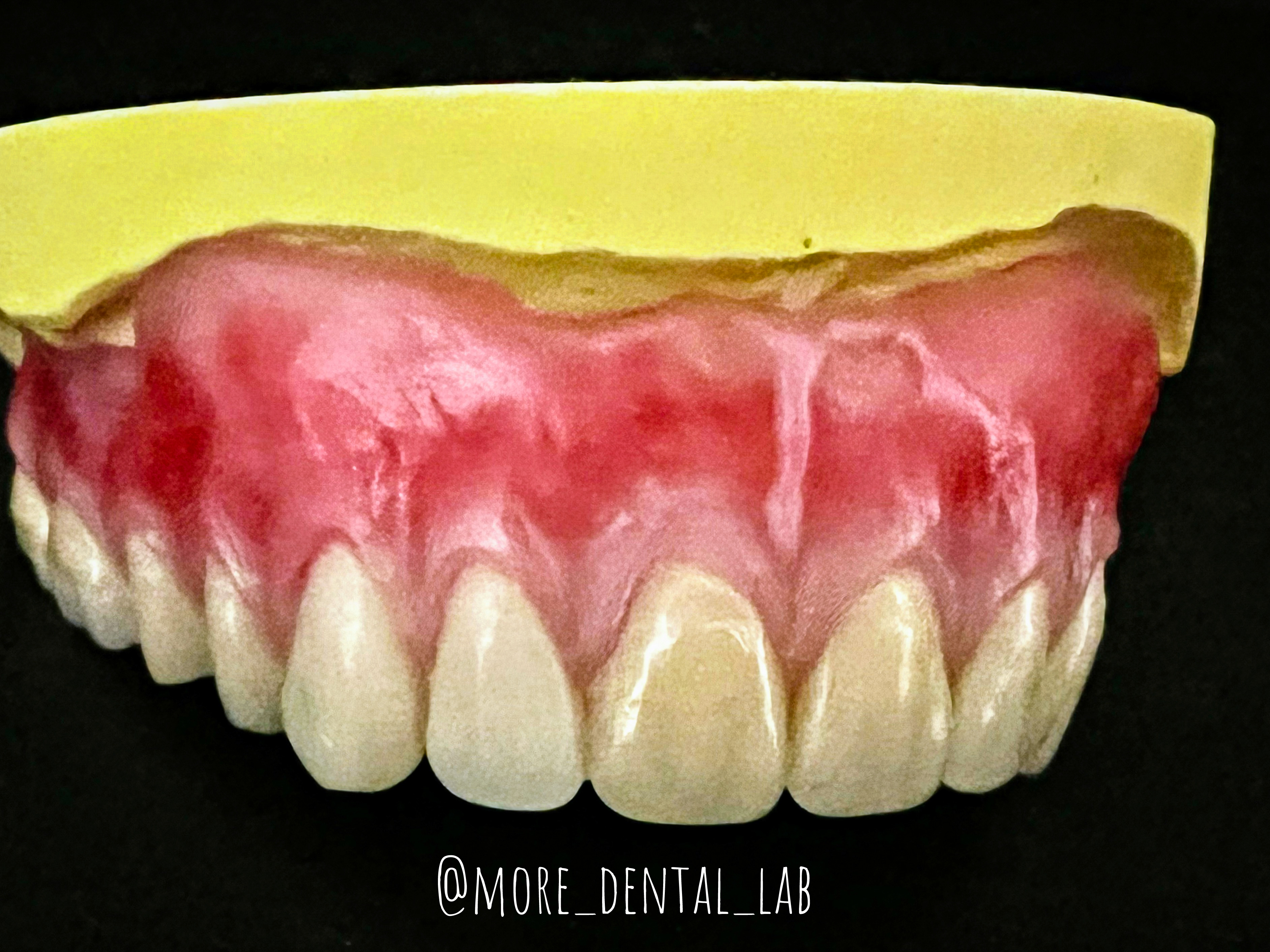 MORE치과기공소 대표 이미지