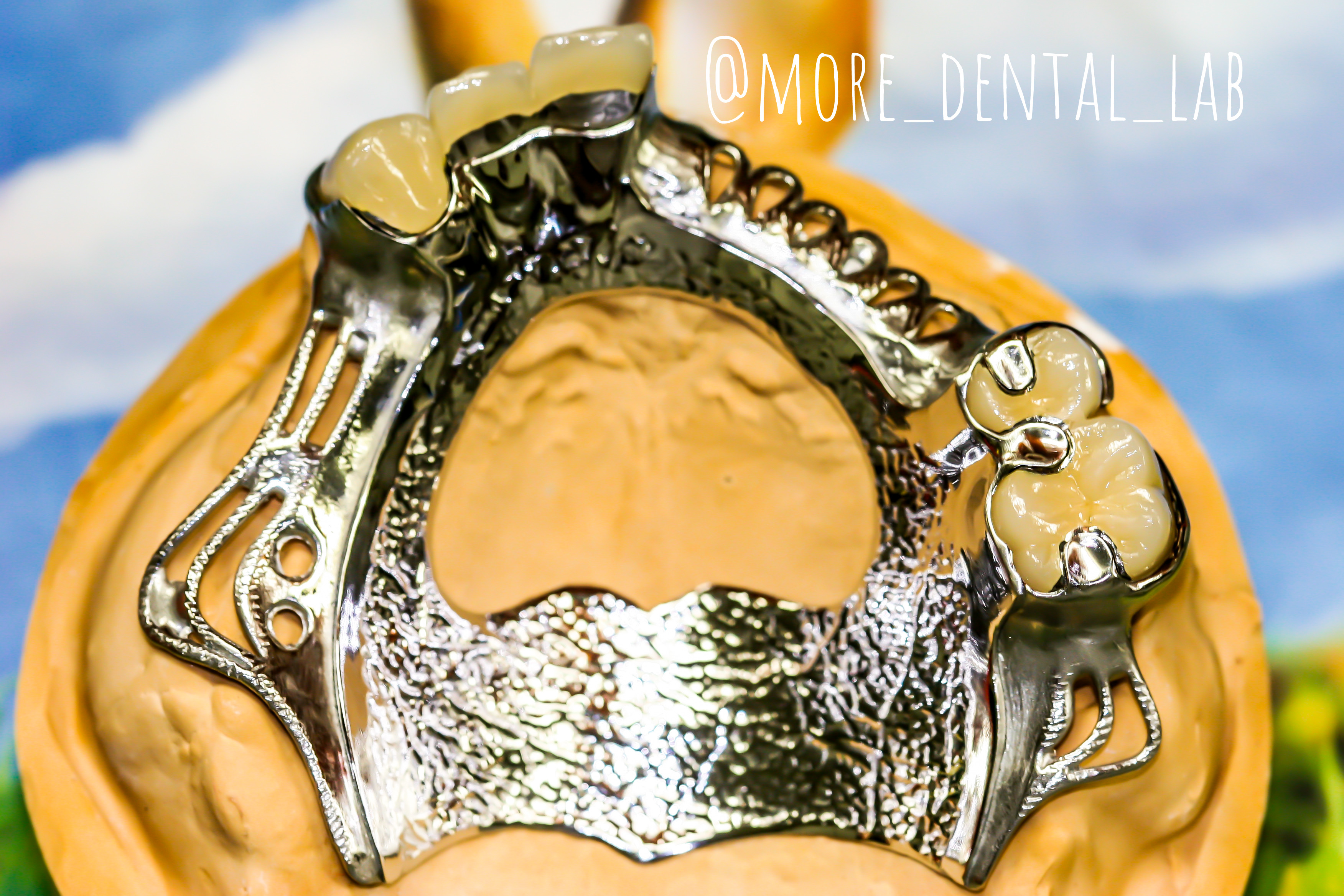 MORE치과기공소 대표 이미지