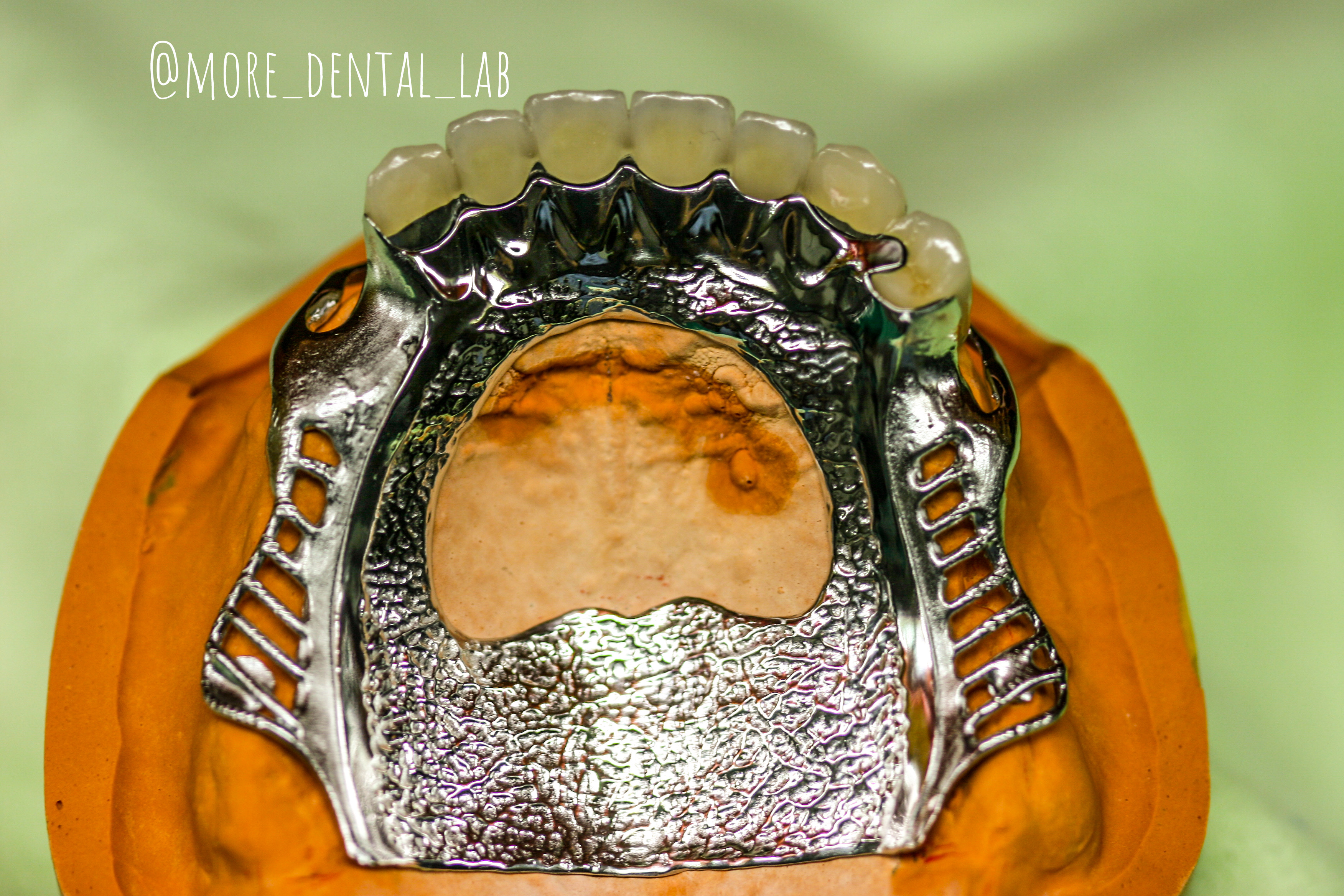 MORE치과기공소 대표 이미지