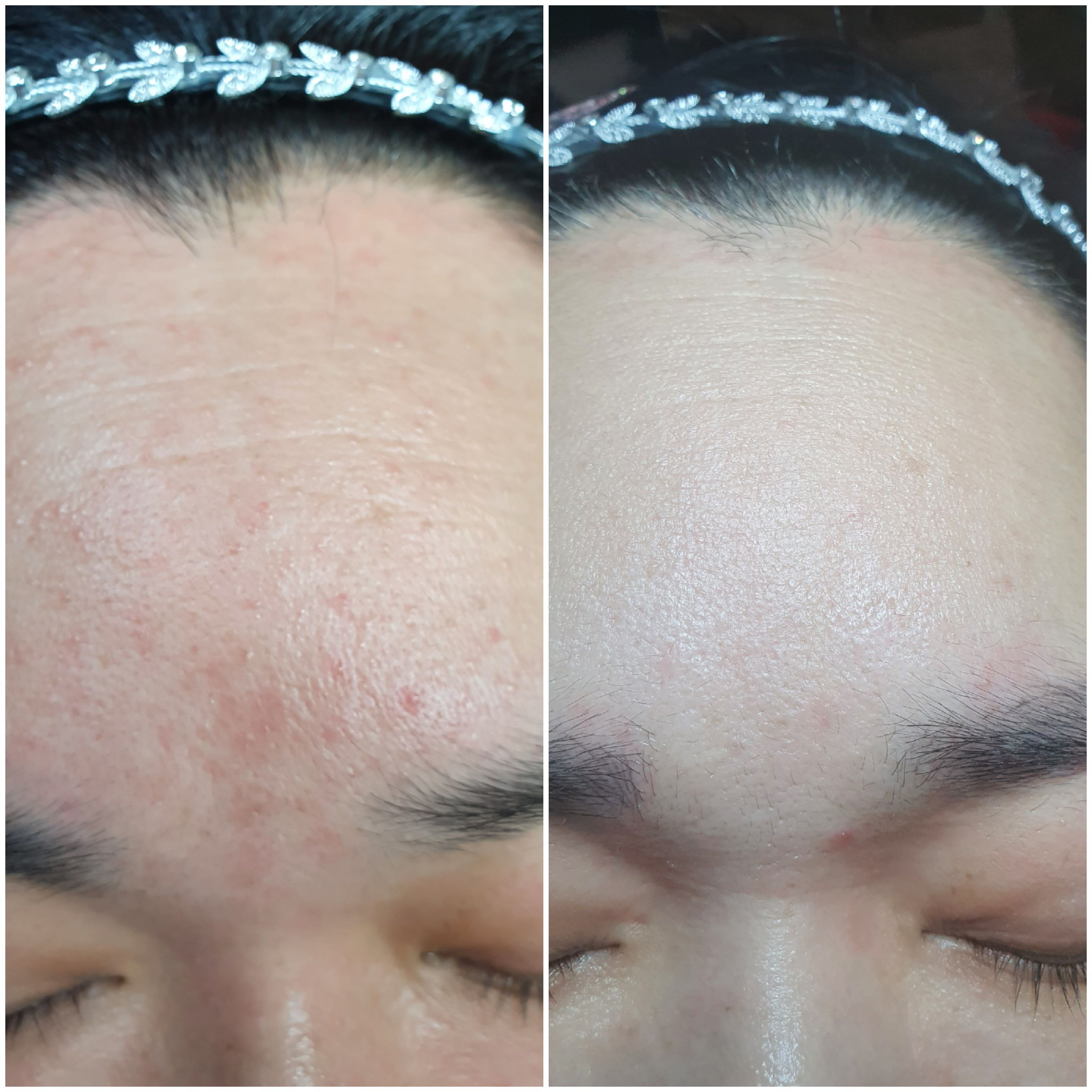 바비걸 속눈썹 대표 이미지