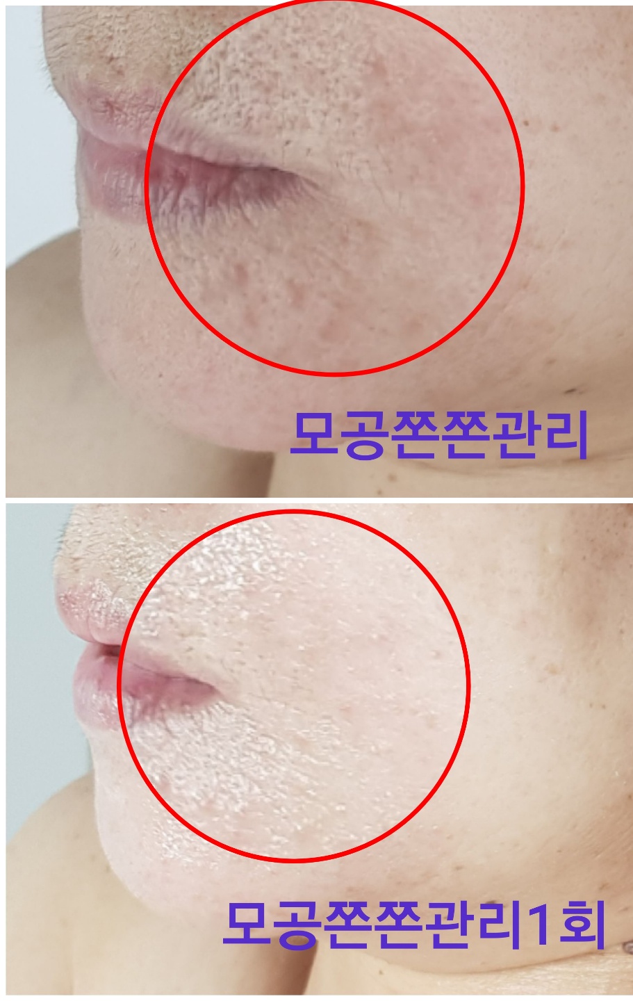 새온뷰티 두골비얼굴축소연구소