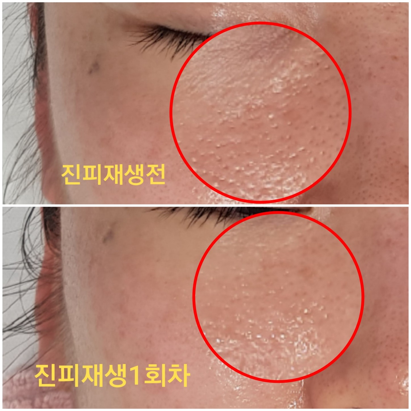 새온뷰티 두골비얼굴축소연구소