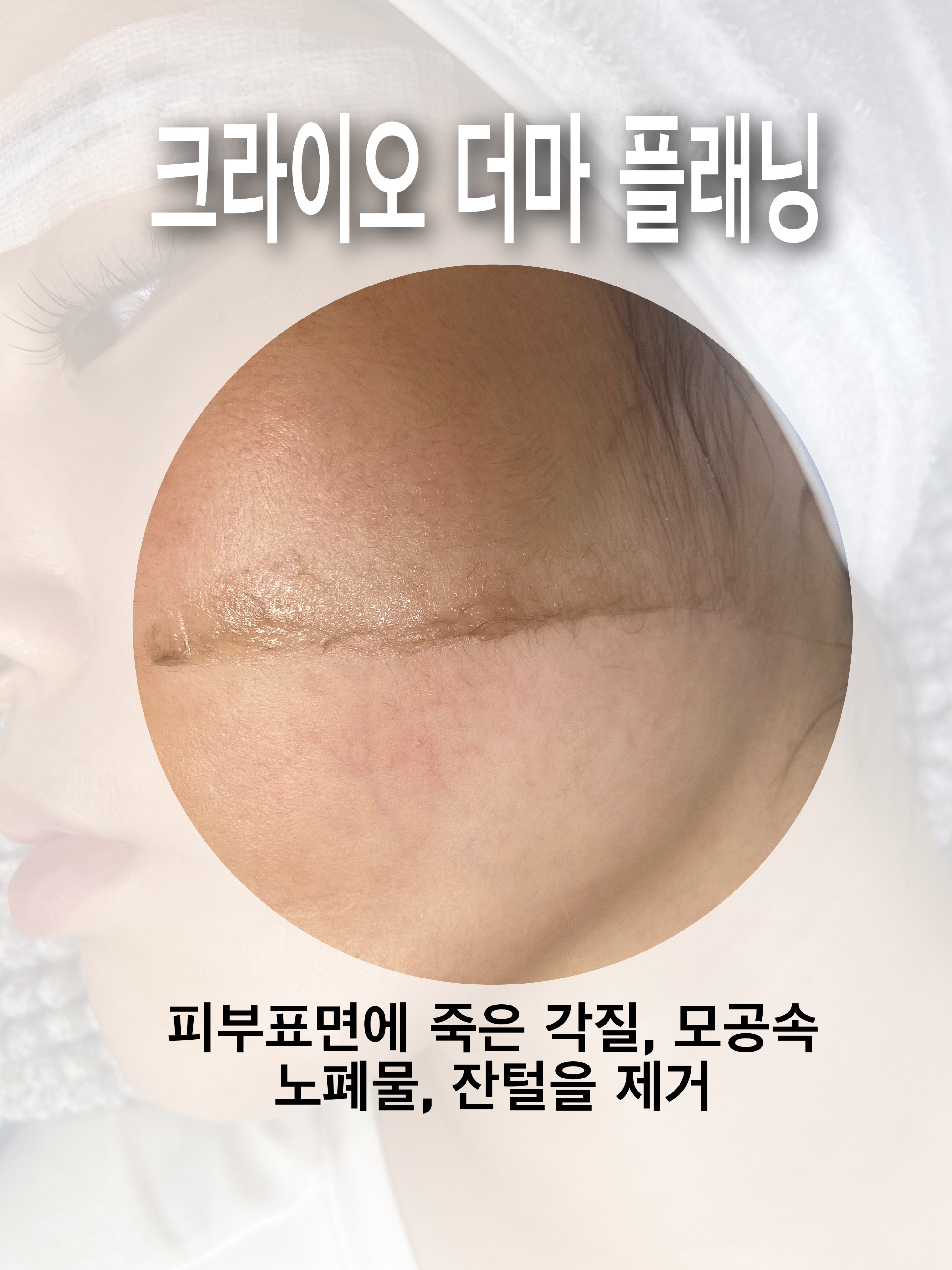 골드래쉬 대표 이미지
