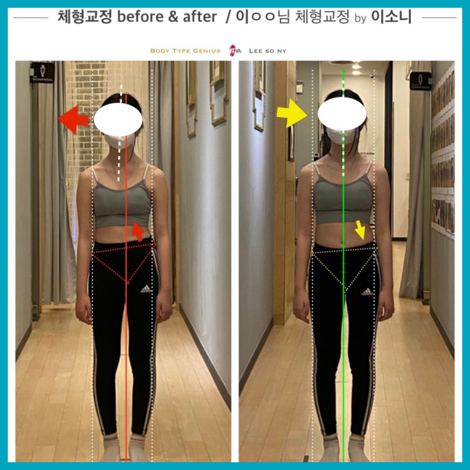 소니드 체형교정센터 대표 이미지