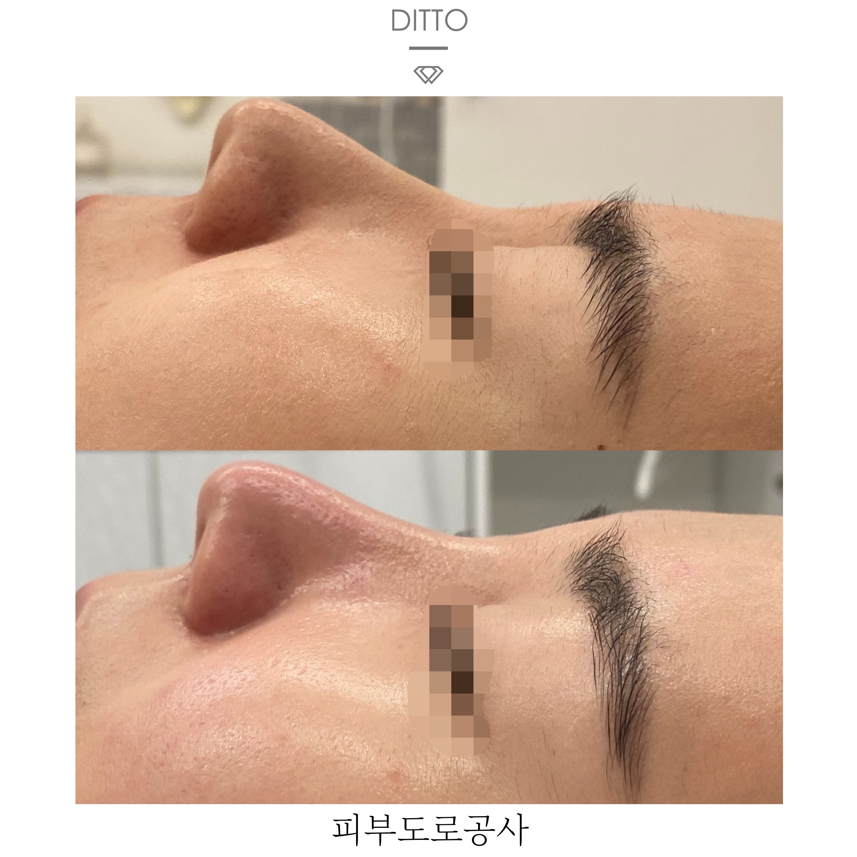 디또뷰티 평택본점