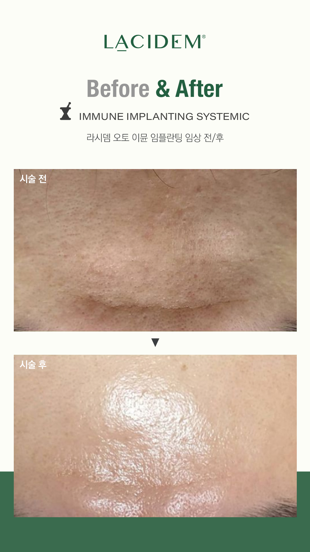 민 피부맑음 대표 이미지