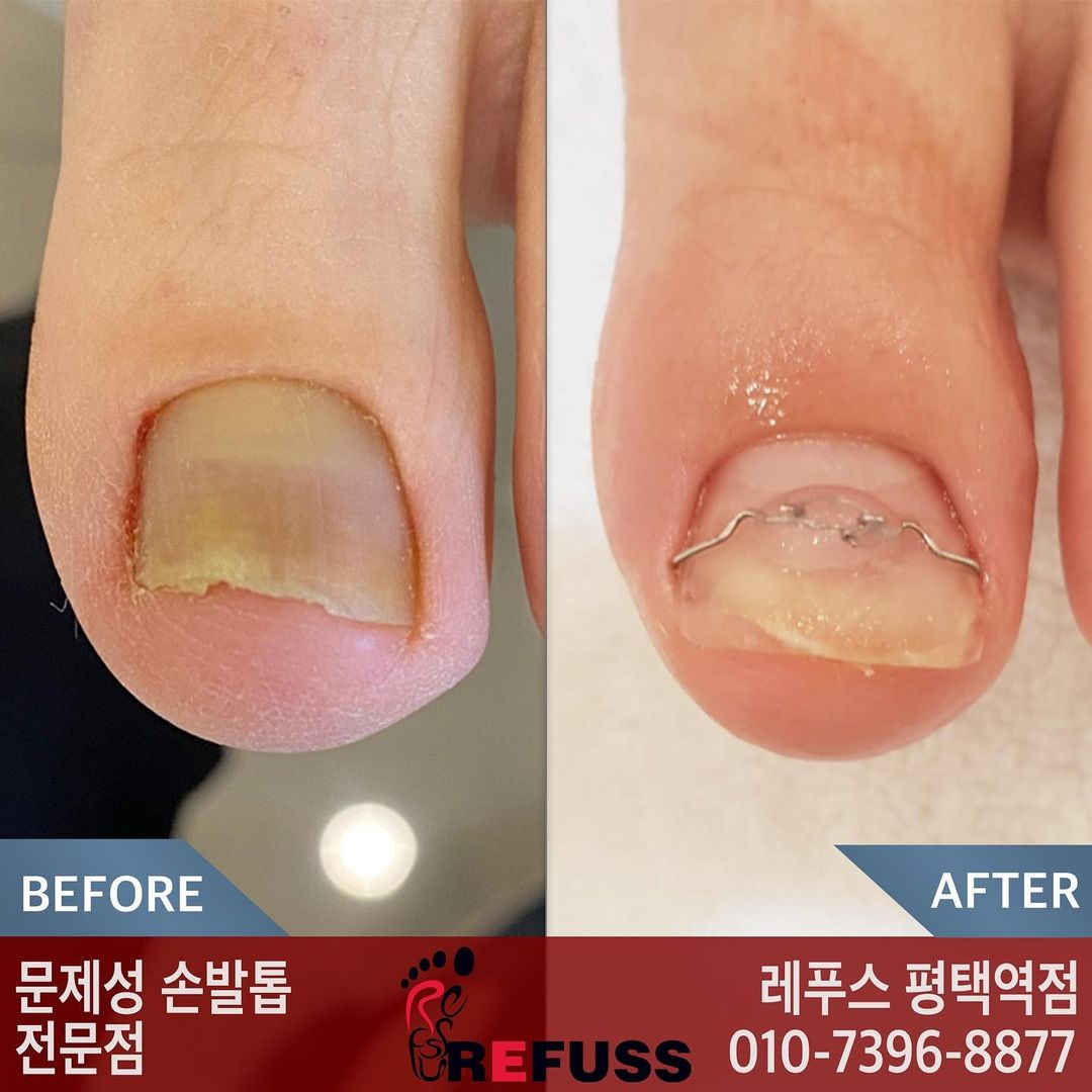 레푸스 평택역점