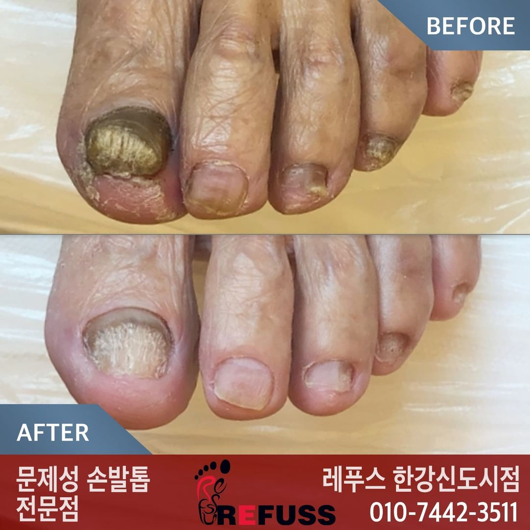레푸스 김포 한강신도시점