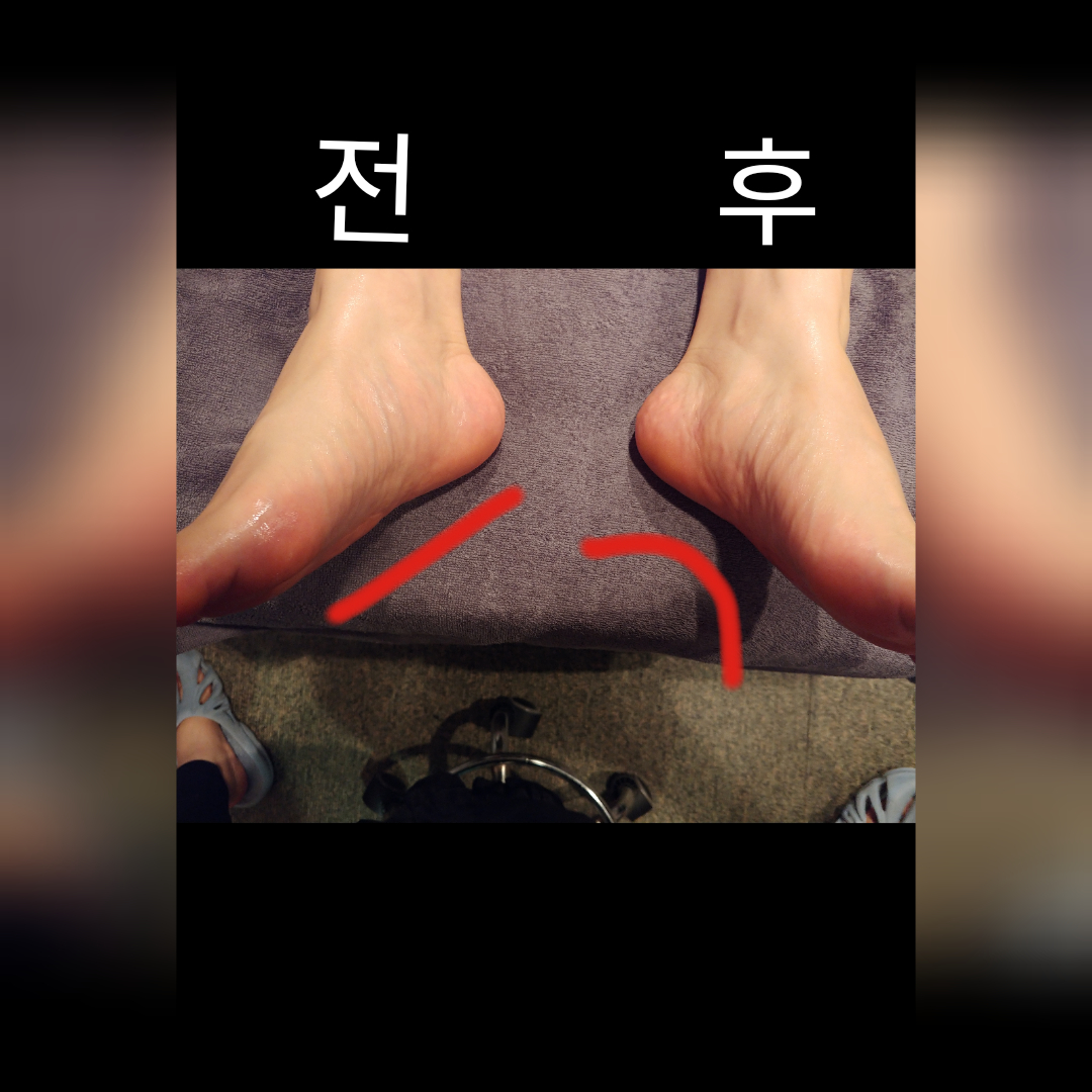 언제나 photo 5