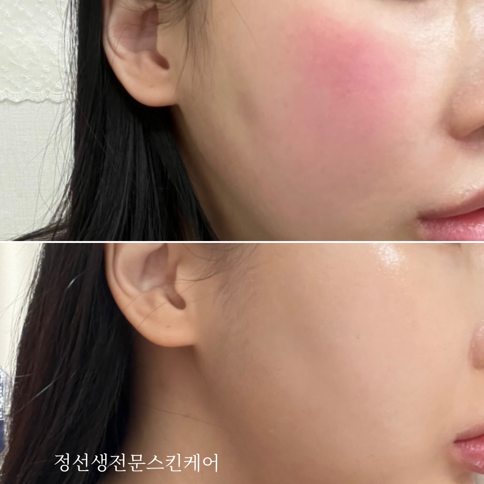 정선생전문스킨케어 대표 이미지