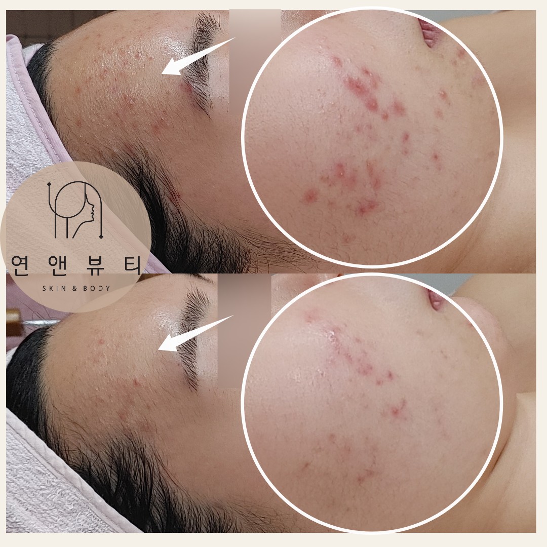 연앤뷰티 목동본점 photo 10