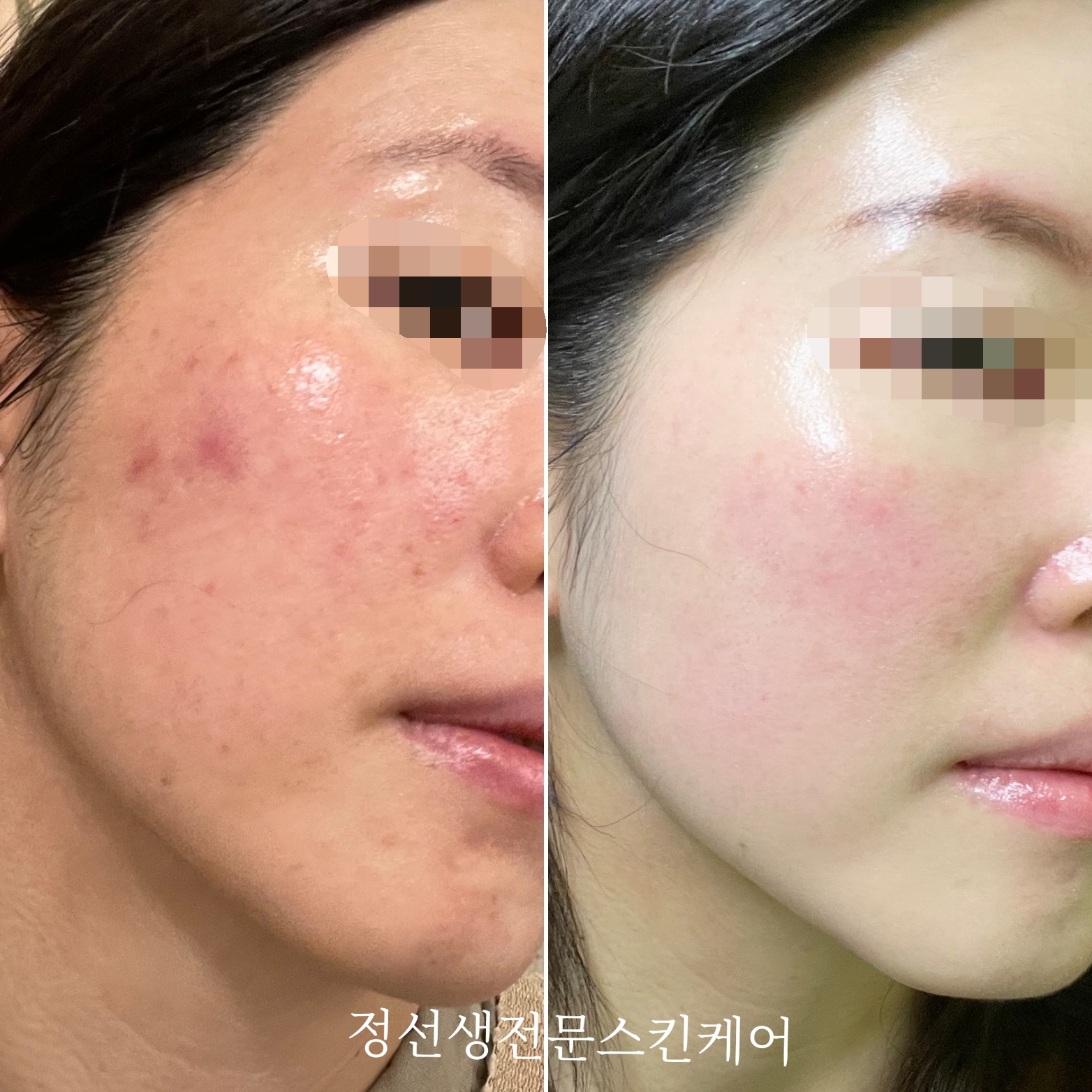 정선생전문스킨케어 대표 이미지