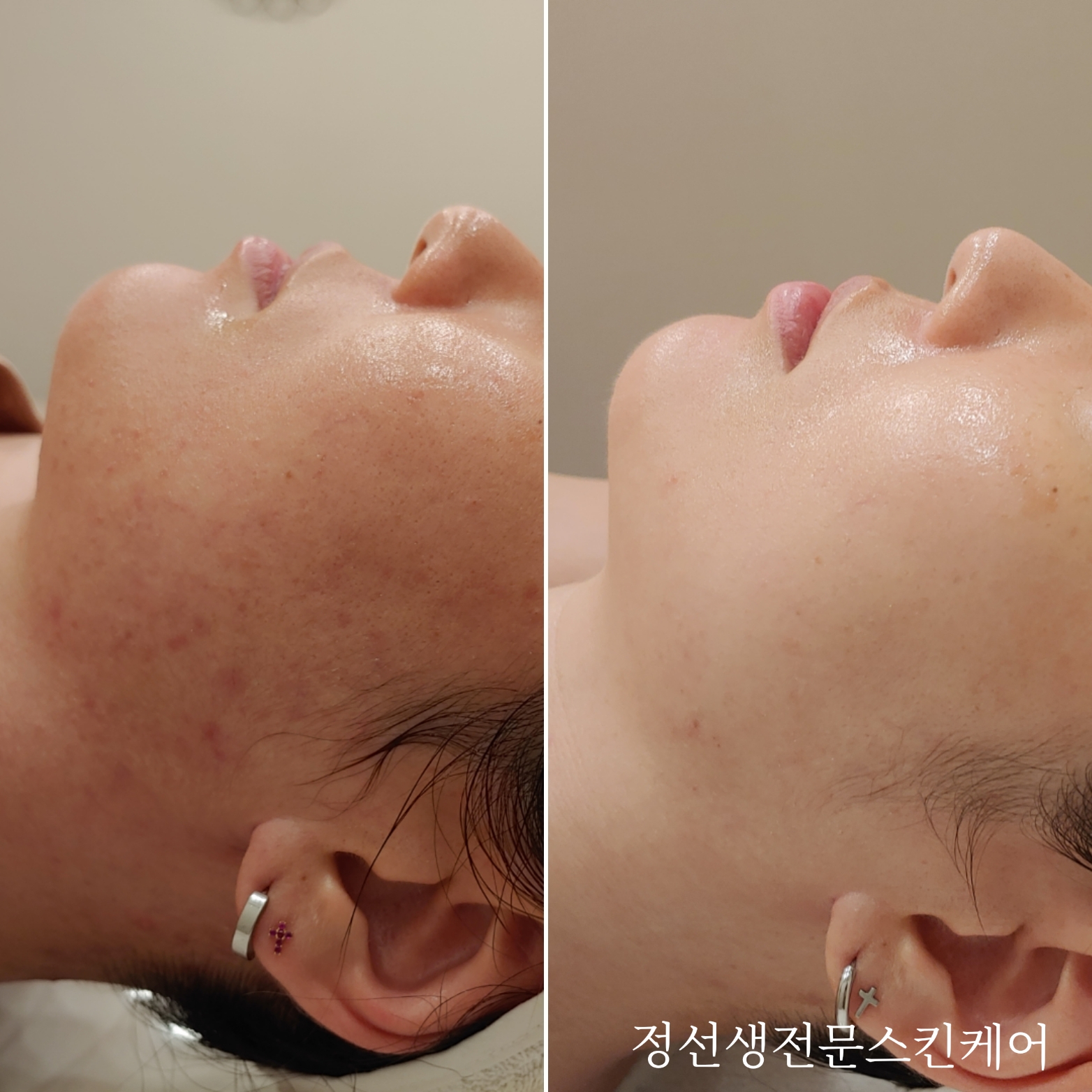 정선생전문스킨케어 대표 이미지