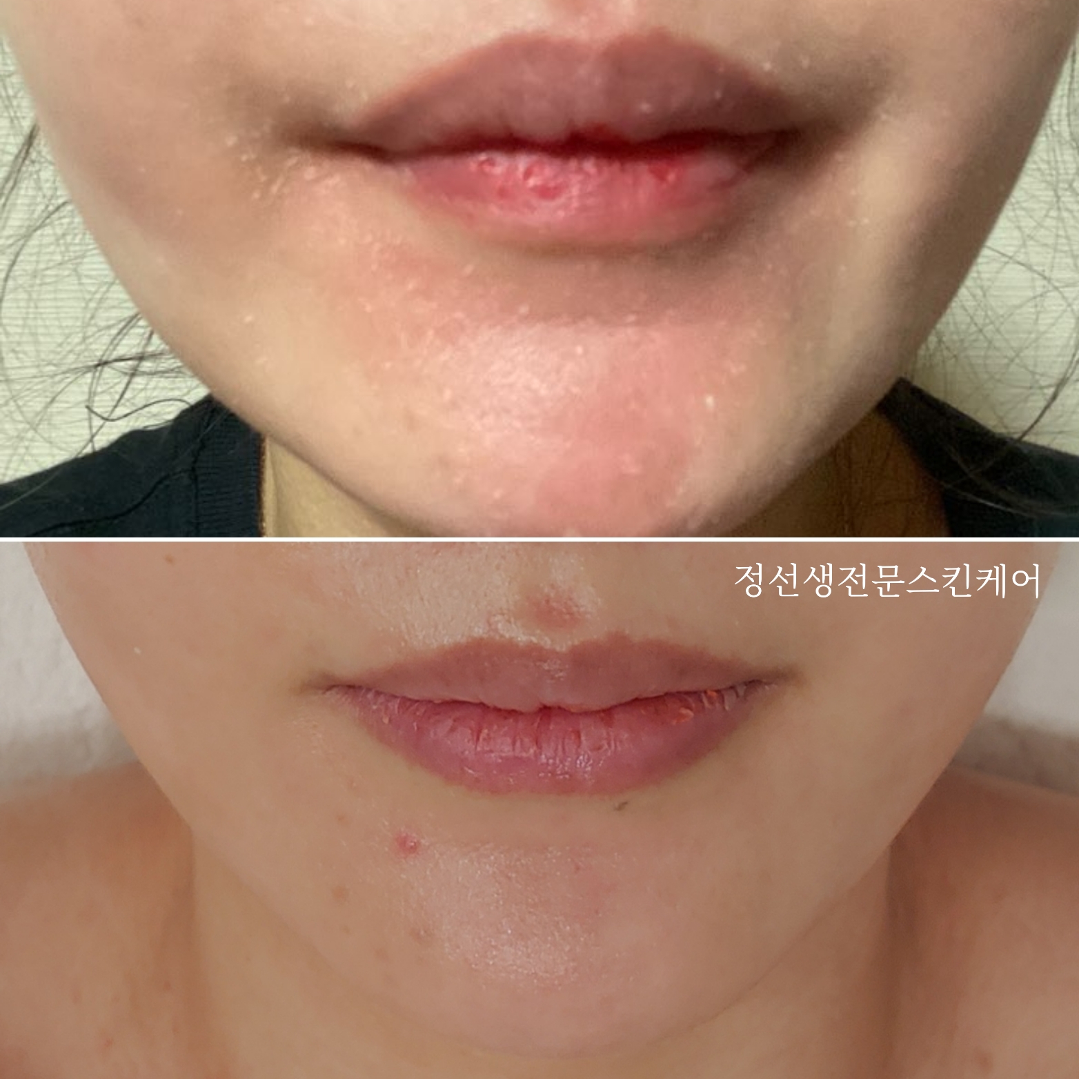정선생전문스킨케어 대표 이미지