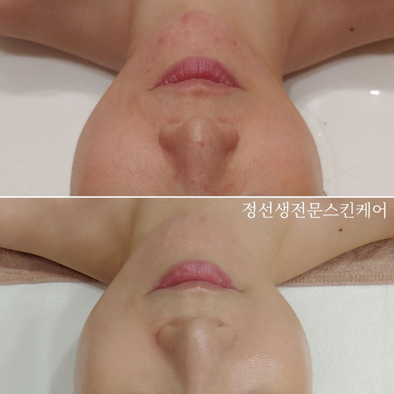 정선생전문스킨케어 대표 이미지