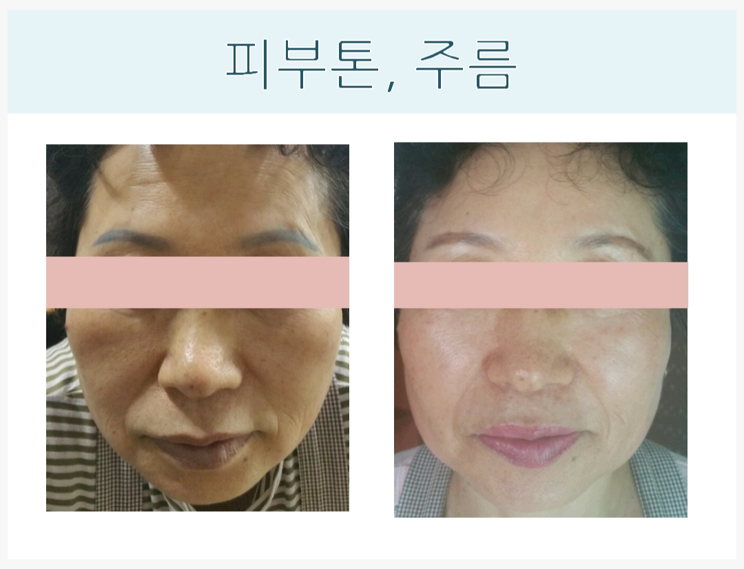 더 끌리지 피부샵