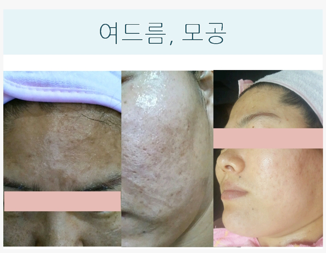 더 끌리지 피부샵