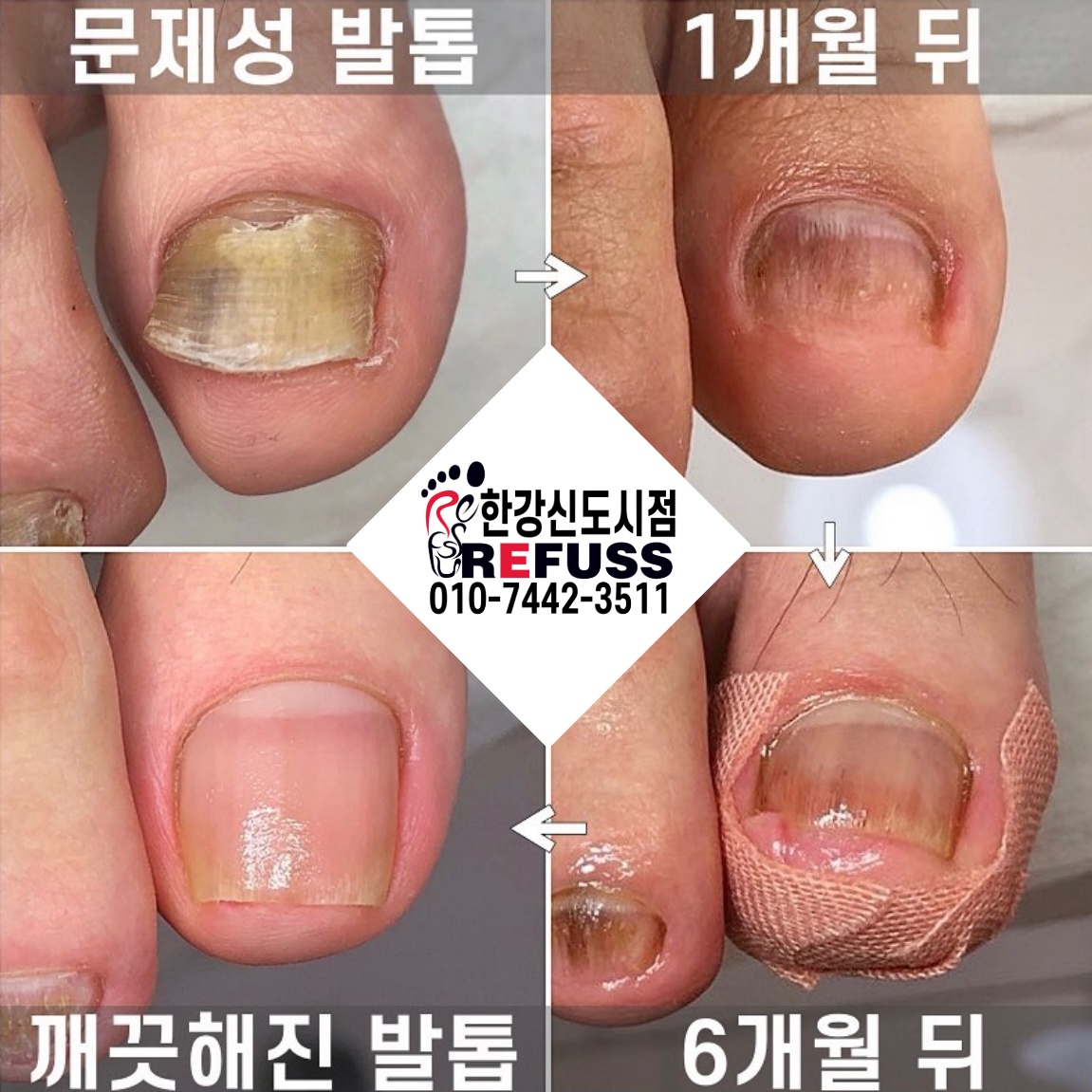 레푸스 김포 한강신도시점
