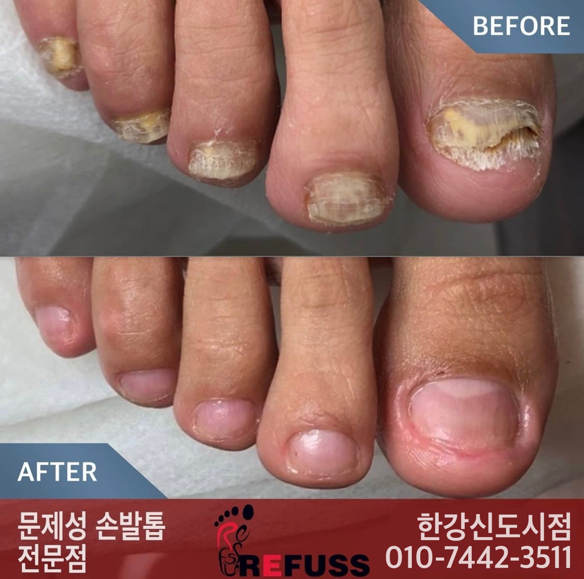 레푸스 김포 한강신도시점