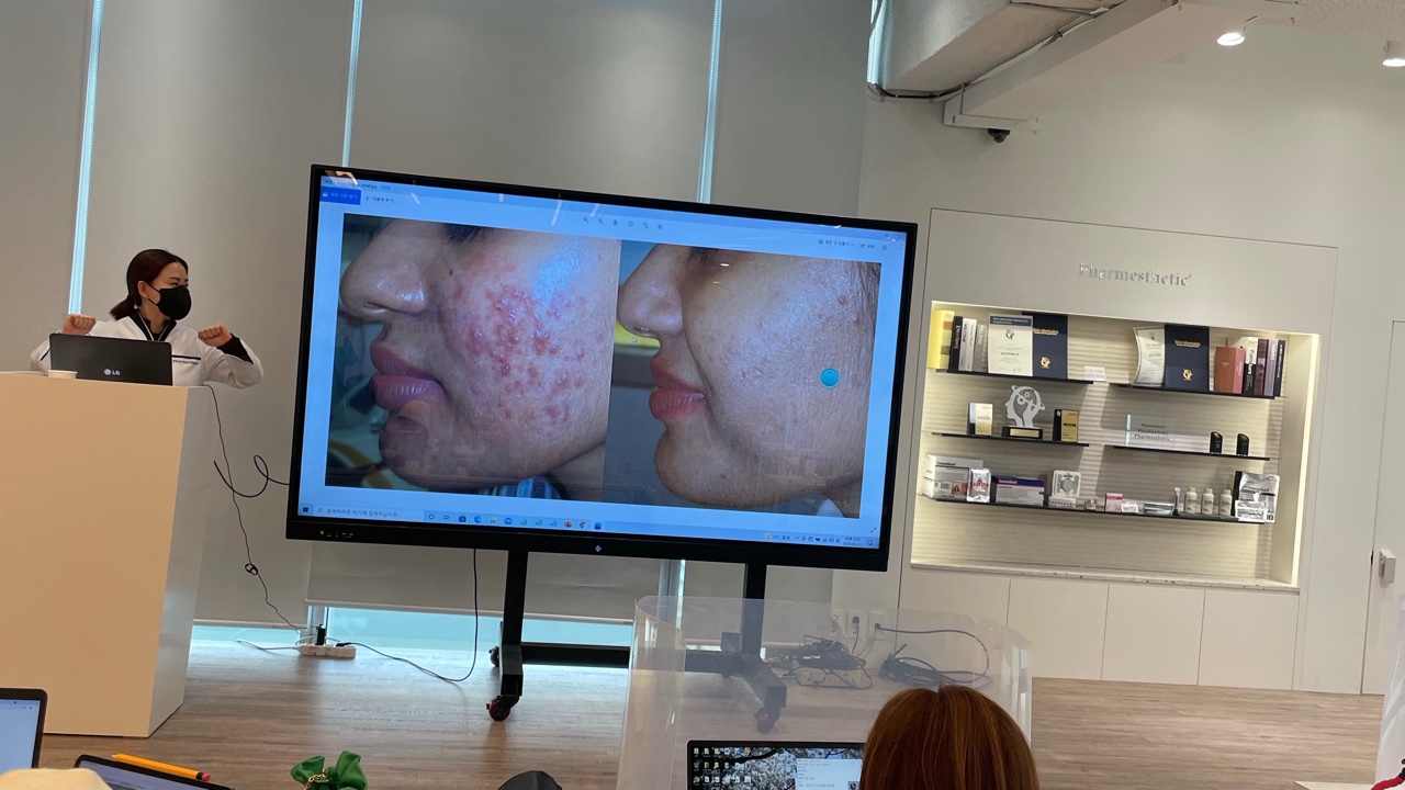소영 SKIN 대표 이미지