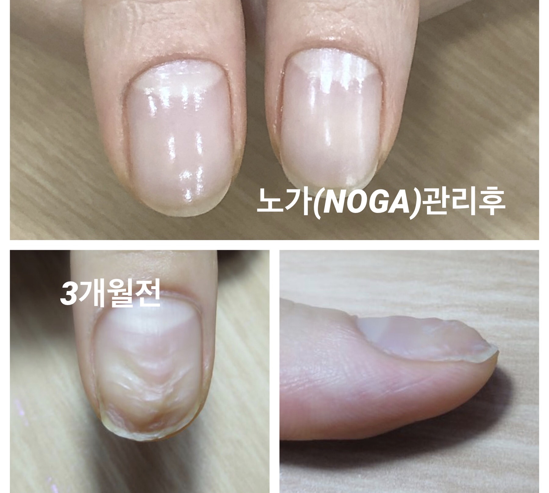 마니큐아 물어뜯는 손톱연장 노가시스템