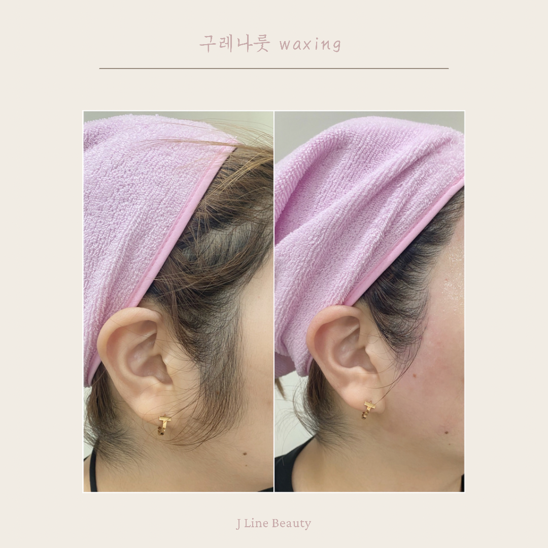 제이라인뷰티