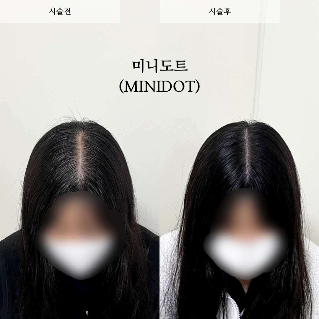 미니도트 대표 이미지