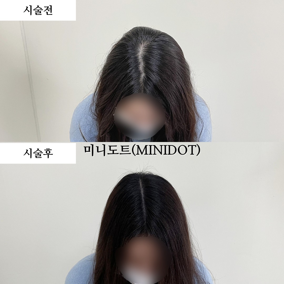 미니도트 대표 이미지