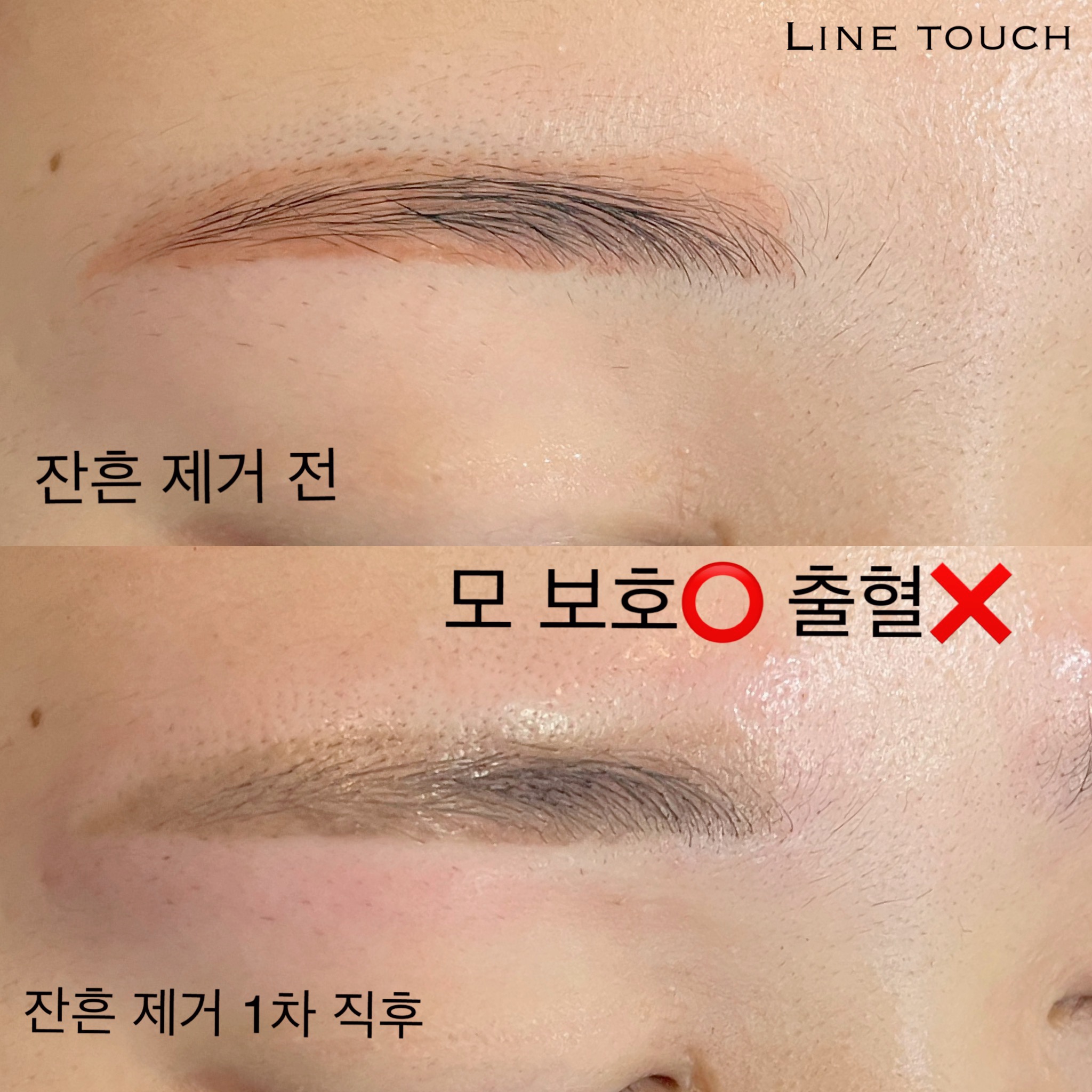 라인터치