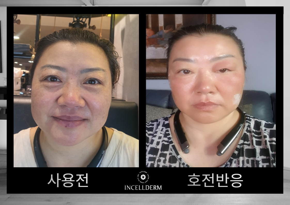 오케이 인셀덤 연수점 대표 이미지