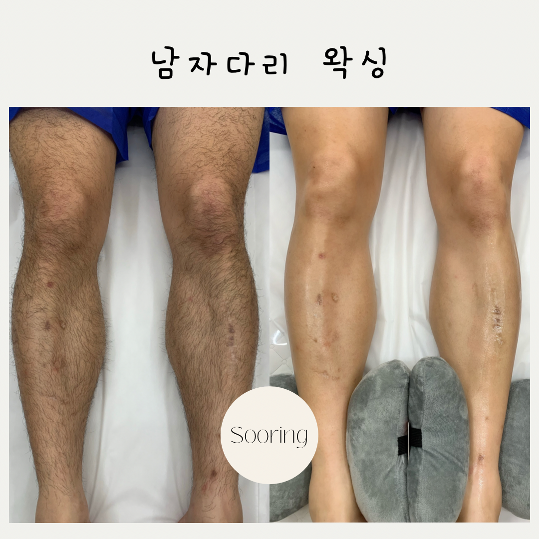 수링왁싱