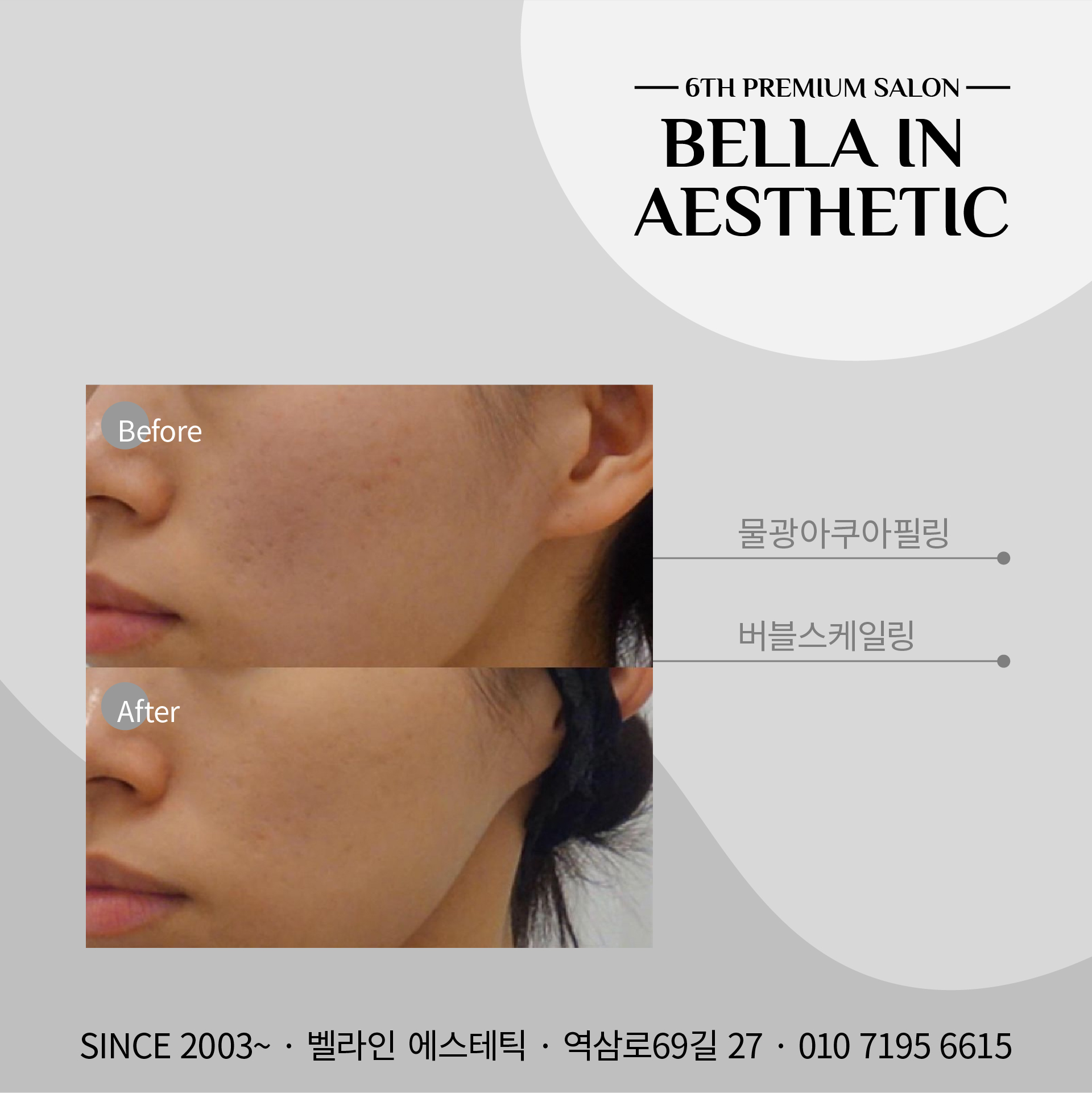 벨라인 에스테틱 강남선릉점