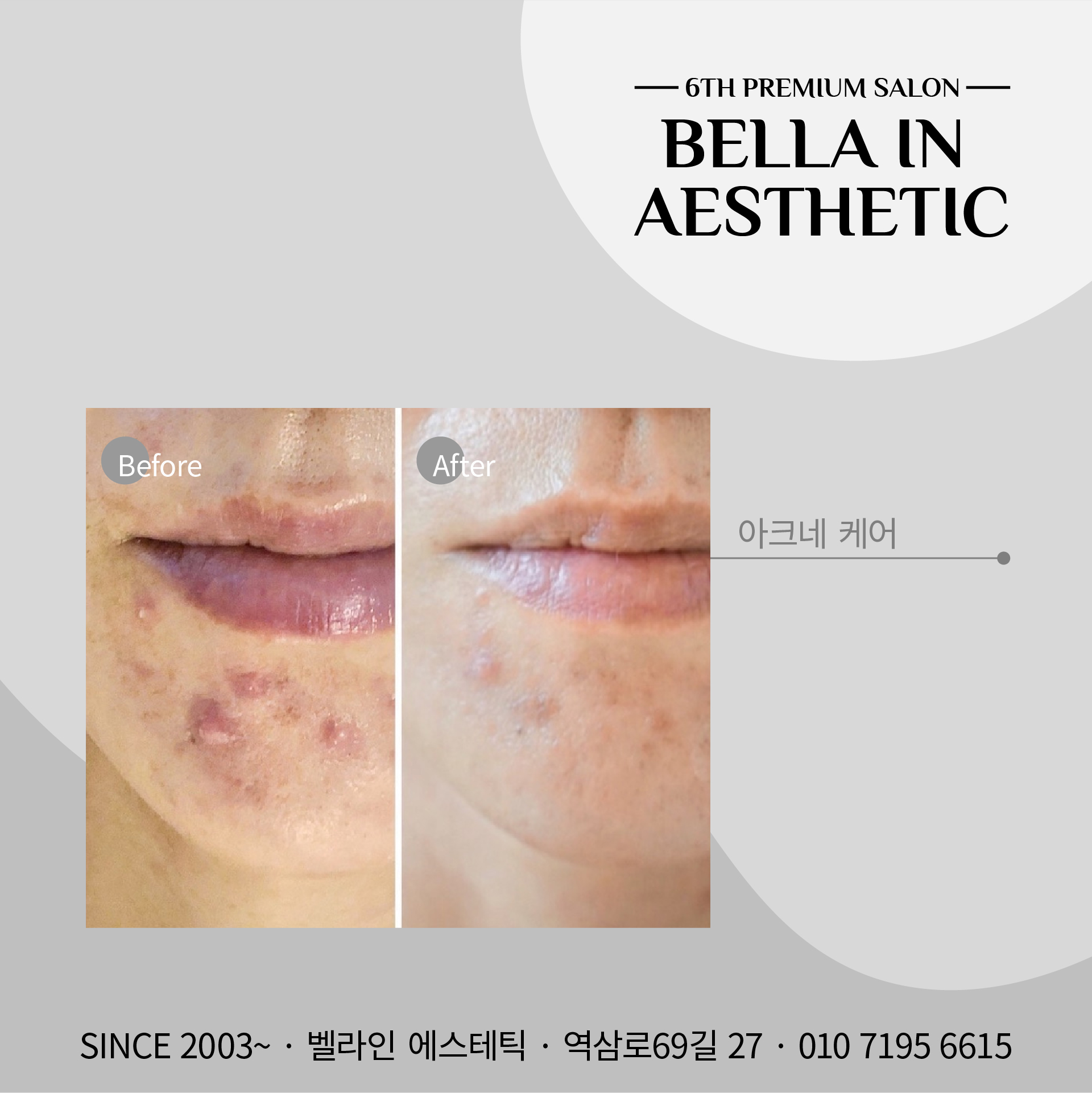 벨라인 에스테틱 강남선릉점 대표 이미지
