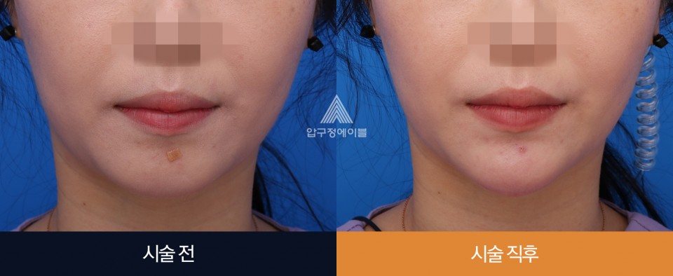 압구정에이블의원 대표 이미지