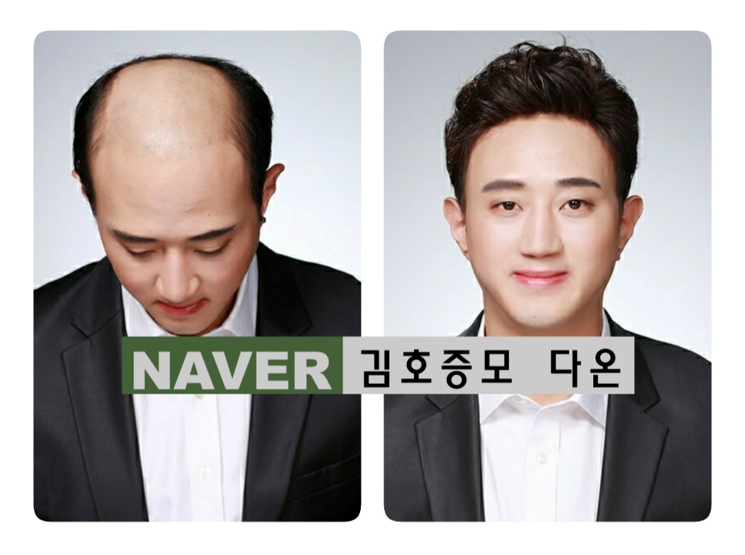 김호증모가발 다온헤어