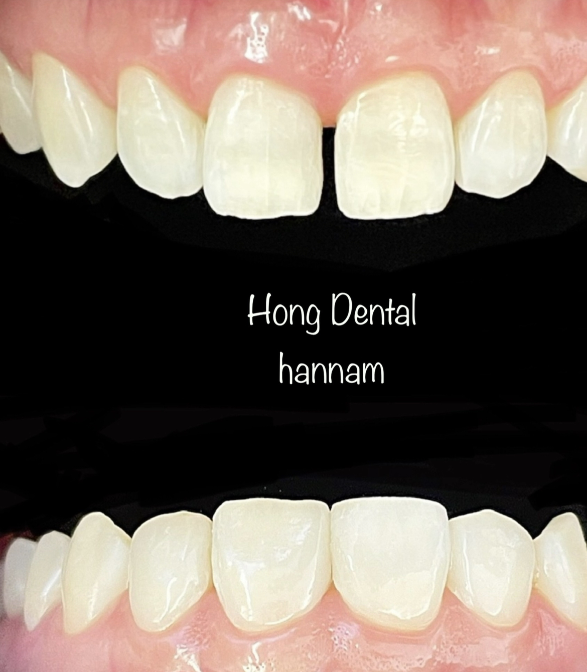 홍치과의원 대표 이미지