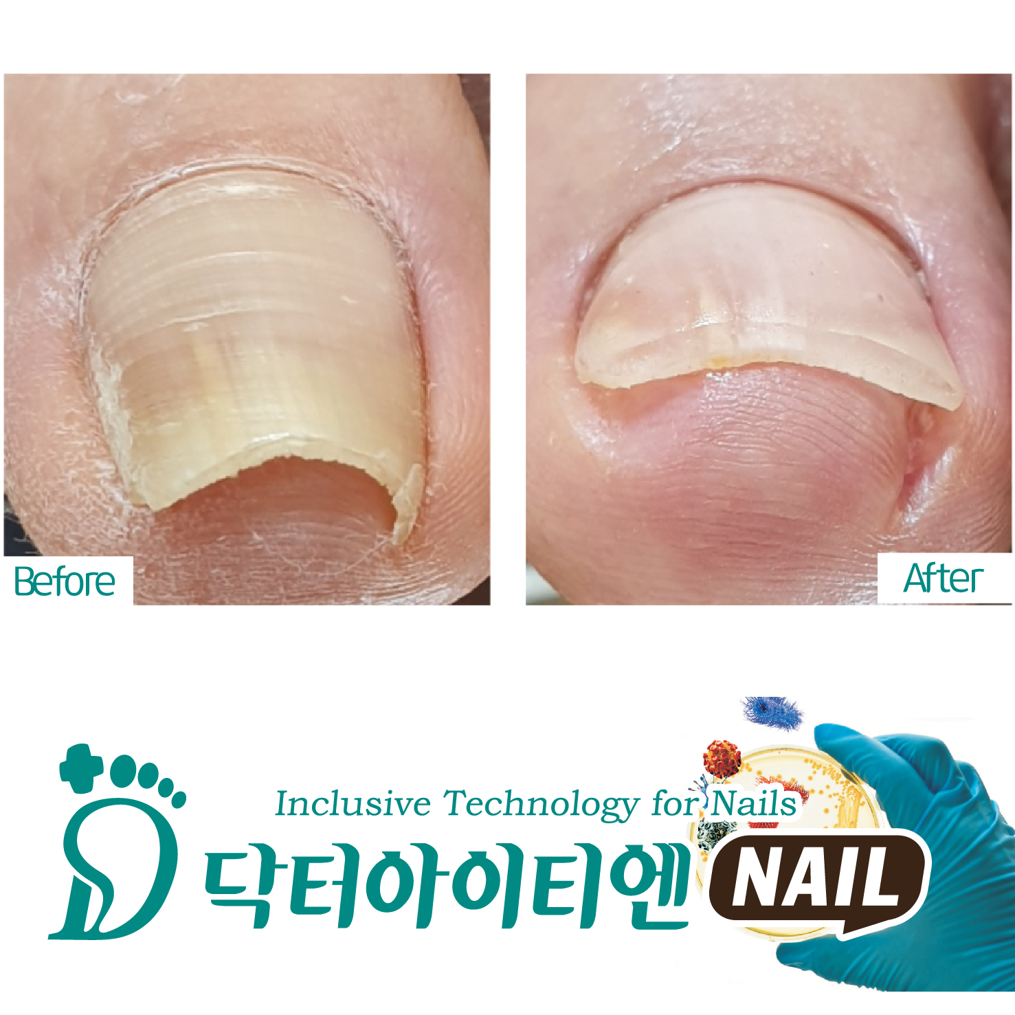 닥터아이티엔네일마벨네일
