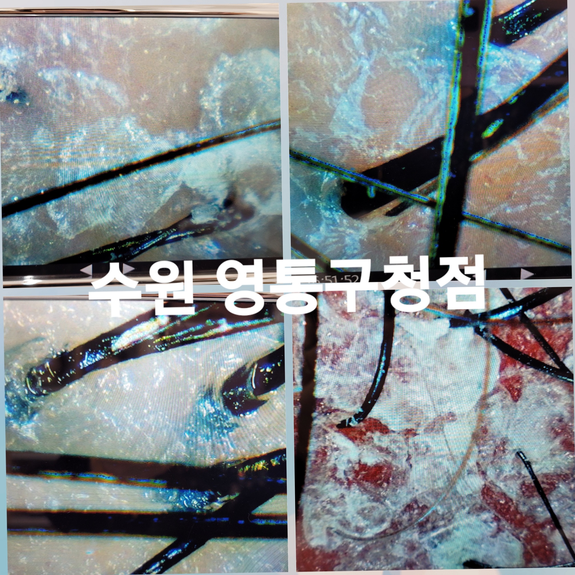 태후사랑 수원영통구청점