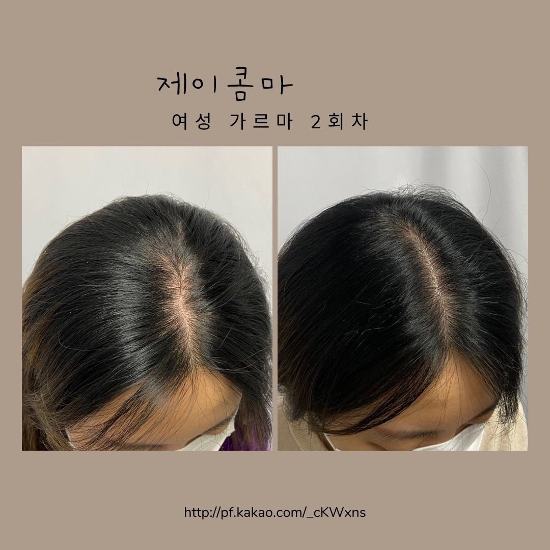제이콤마