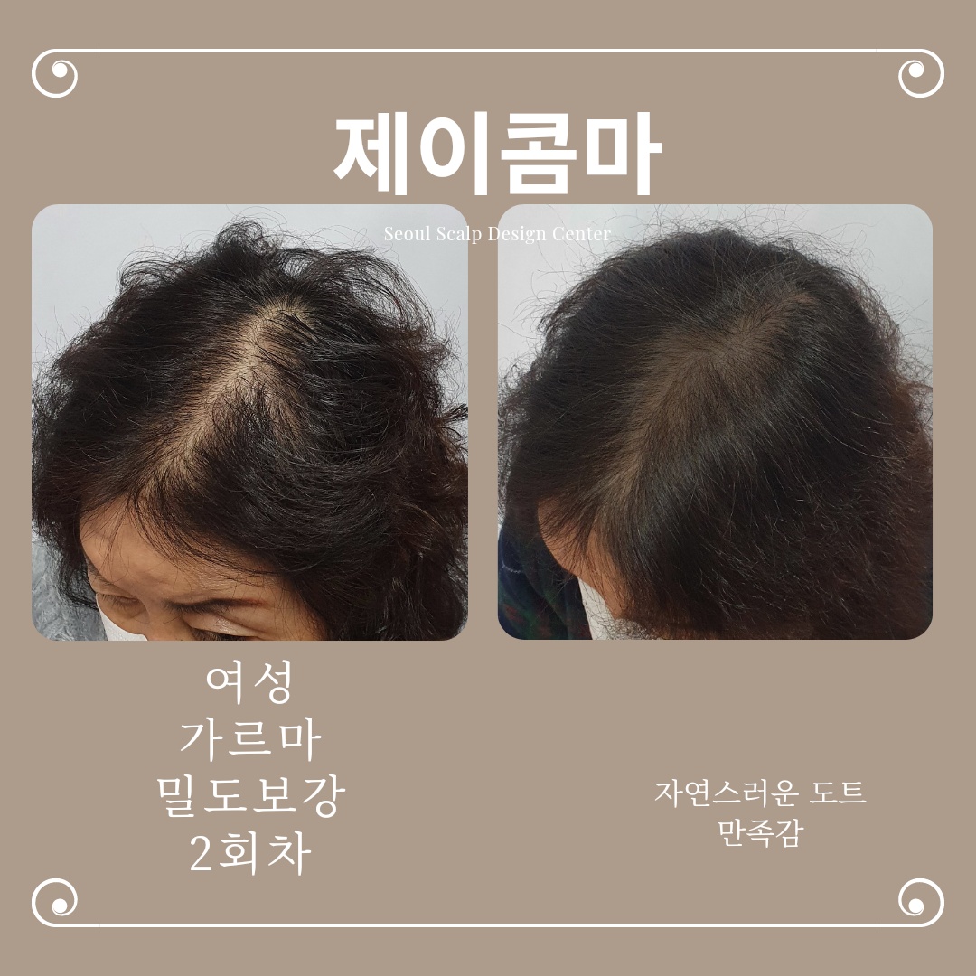 제이콤마